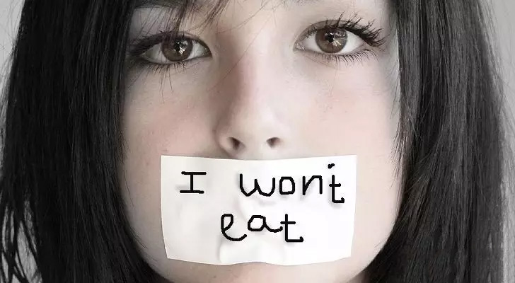 بی اشتهایی عصبی ( Anorexia Nervosa)